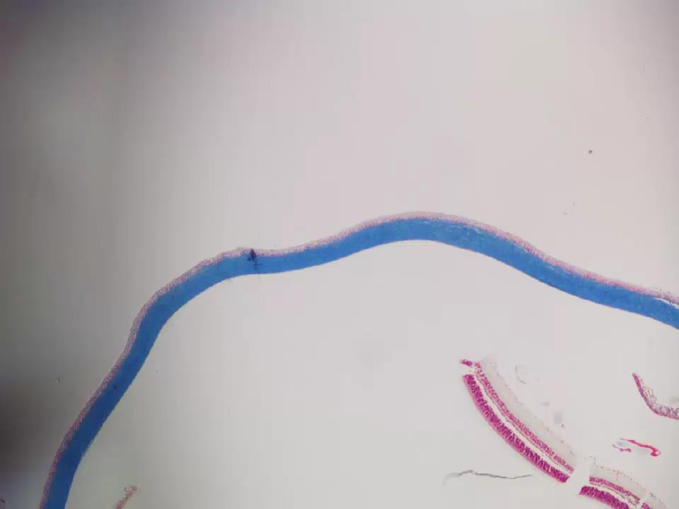 D14_5